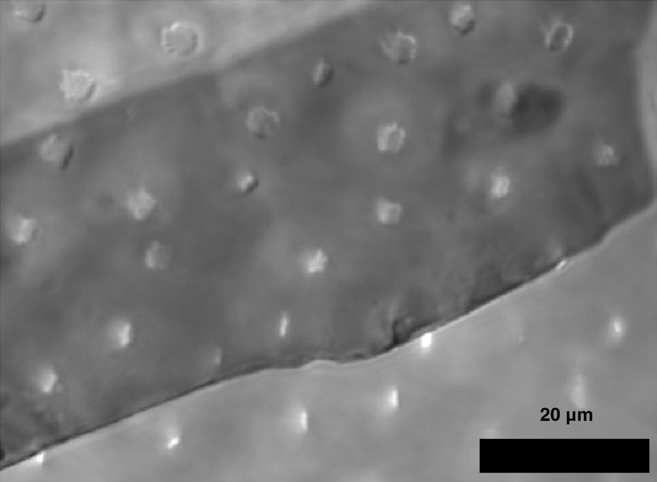 Micrograph of hair bundles beneath a transparent mica membrane