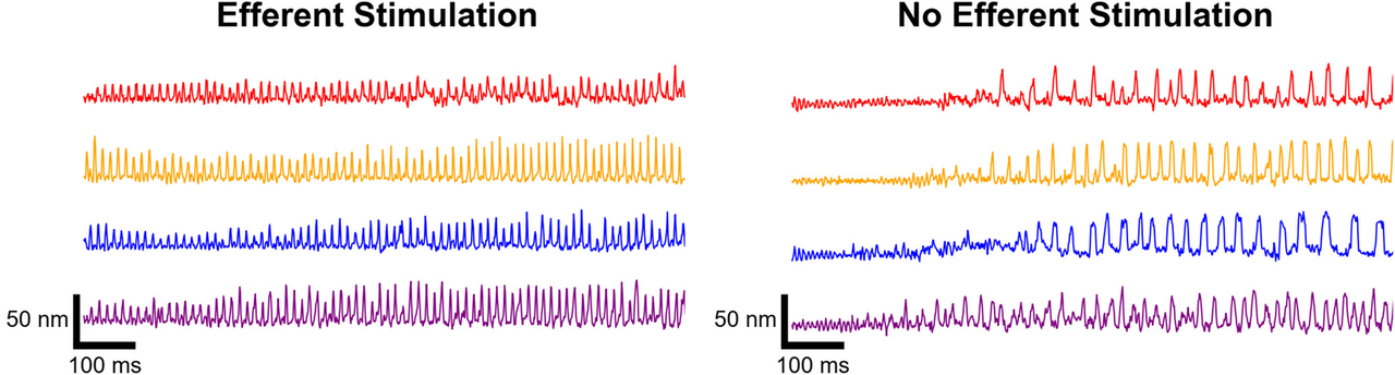 Hair-bundle traces after overstimulation, with and without efferent stimulation